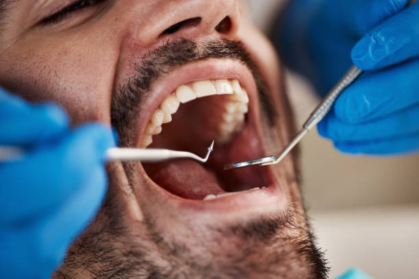 Best Urgent Tooth Repair  in El Dorado Springs, MO